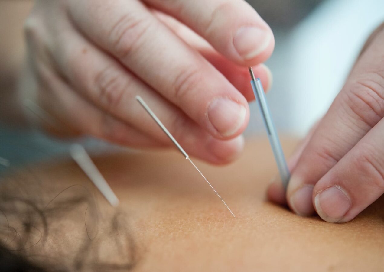 Où se trouve le point d’acupuncture de l’estomac ?